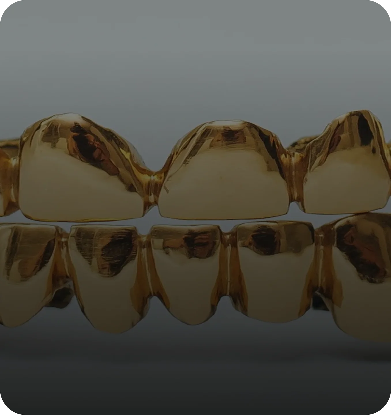 Gold for Cash Rochester, Cash for Diamonds Rochester, Diamond Buyers Rochester, Watch Buyer Rochester, Layaway Rochester, gold Grillz Rochester, grillz Rochester, Rare Antiques Rochester, pawn shop Rochester, Estate Buyers Rochester, sell diamond jewelry Rochester, Cash for Gold Rochester, Bridal Sets Rochester, sell gold Rochester, buy gold Rochester